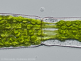 pleurotaenium_truncatum2b