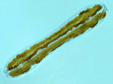 gomphonema___sp.