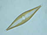 surirella_sp.