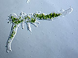 acanthocystis__sp.2l