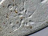 paramecium__kv__df1